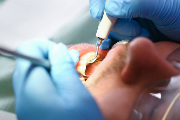 Best Same-Day Emergency Dentist in Two Rivers, WI