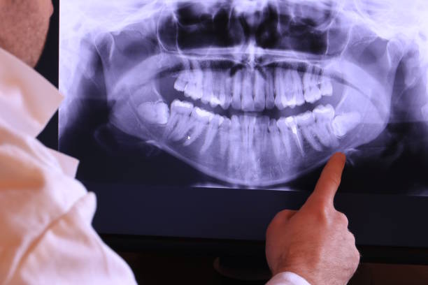 Best Emergency Root Canal Treatment in Two Rivers, WI