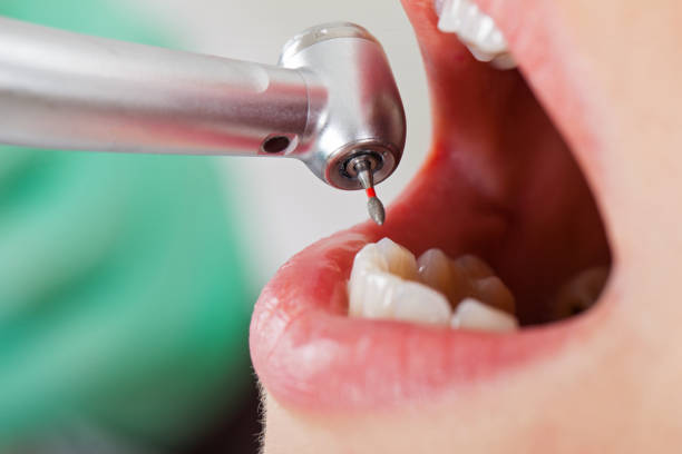 Best Emergency Tooth Extraction in Two Rivers, WI